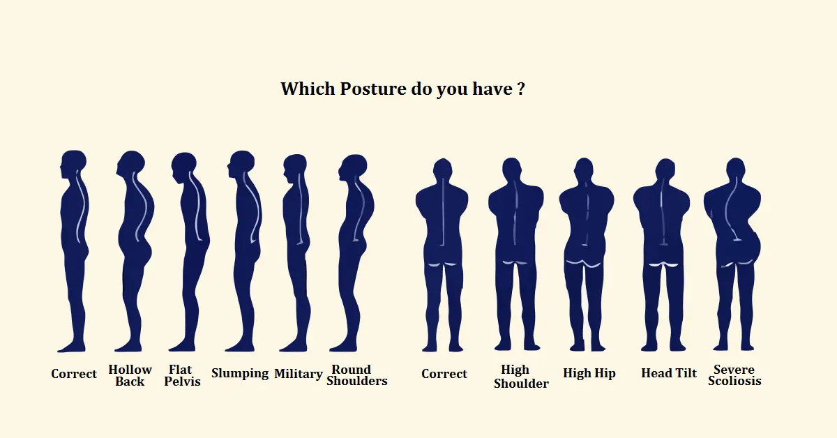 Posture Perfect: Are you standing the right way?